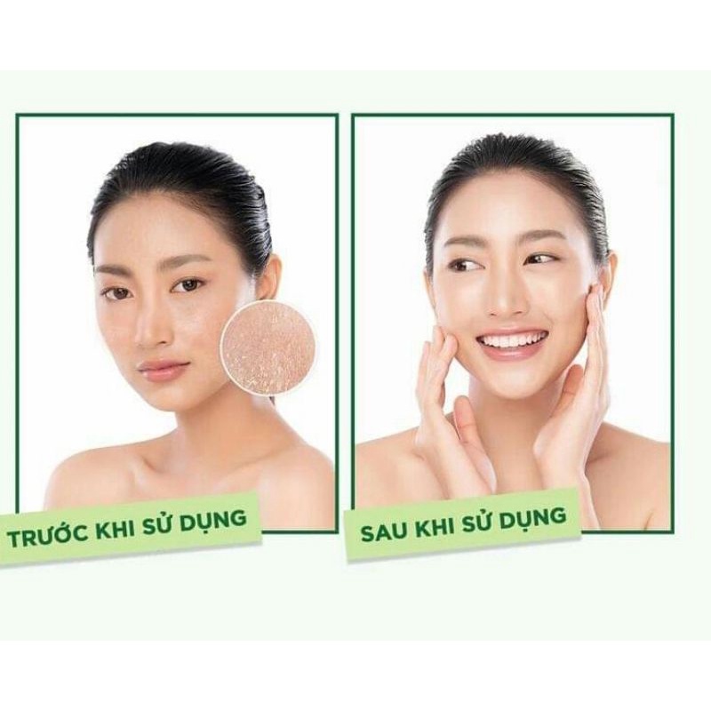 Sữa Rửa Mặt Simple Kind To Skin 150ml