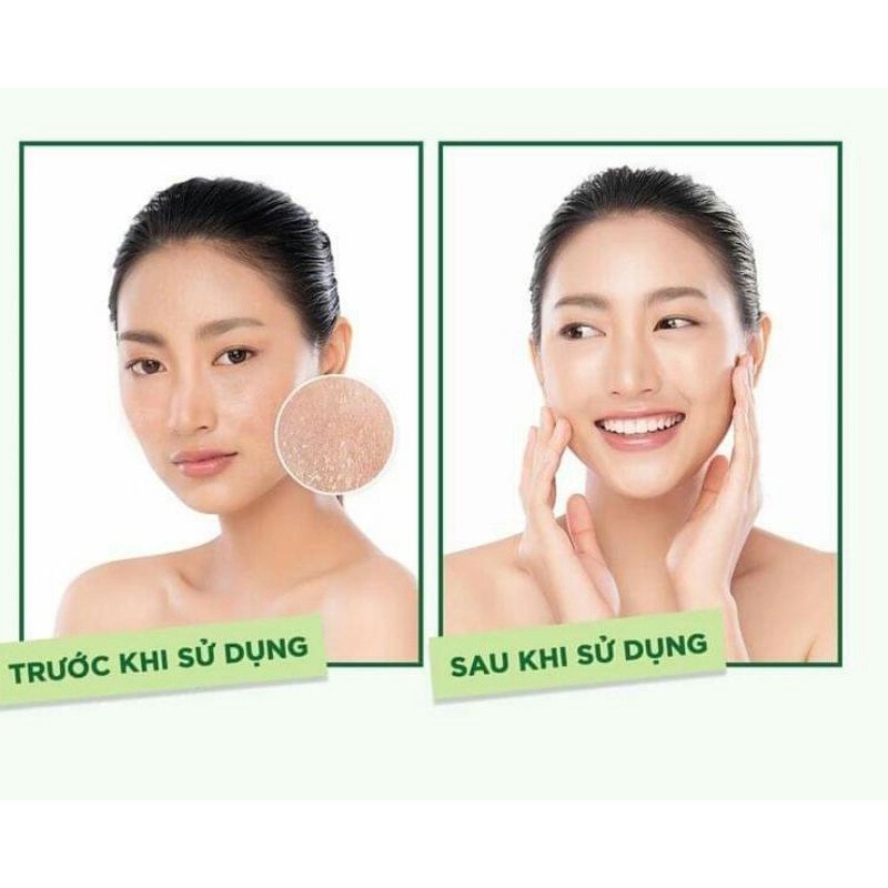 [ Mới Về] Sữa Rửa Mặt Simple Kind To Skin 150ml