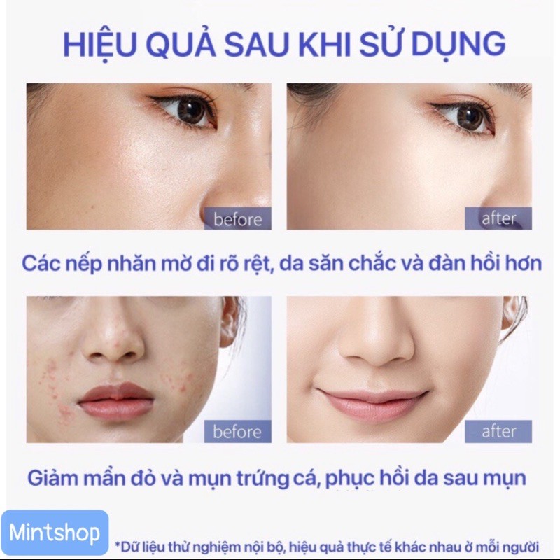 LUCENBASE TINH CHẤT BLUE COPPER PEPTIDE CHỐNG LÃO HOÁ, GIẢM VIÊM VÀ CẤP ẨM