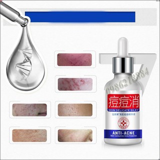 Tinh dầu cho da mụn Bioaqua  PH