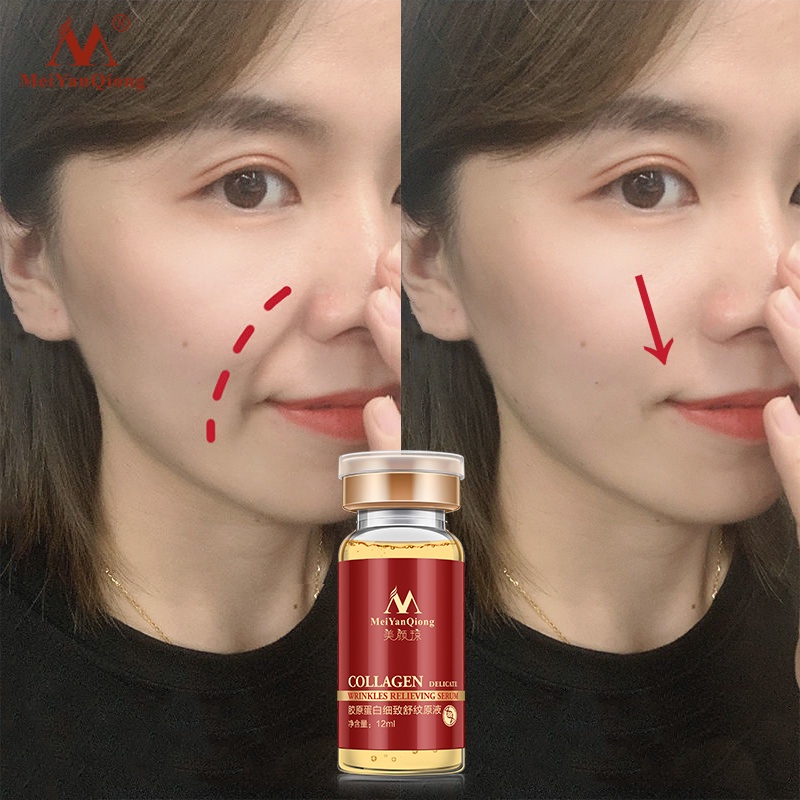 Tinh Chất Collagen MeiYanQiong Giúp Cải Thiện Nếp Nhăn Ngừa Lão Hóa Hiệu Quả 12ml