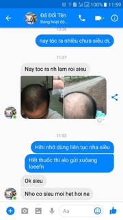 Thuốc xịt mọc tóc Neo Hair Lotion