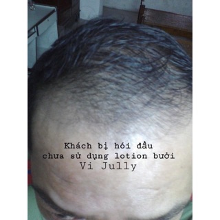 ( Tặng kẹp tóc và Ví  ) Combo 5 chai tinh dầu bưởi Vi Jully