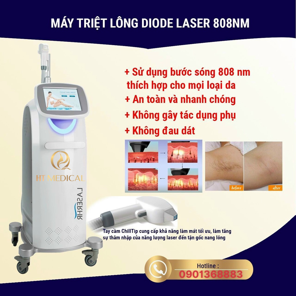 Máy Triệt Lông DIODE Laser 808nm