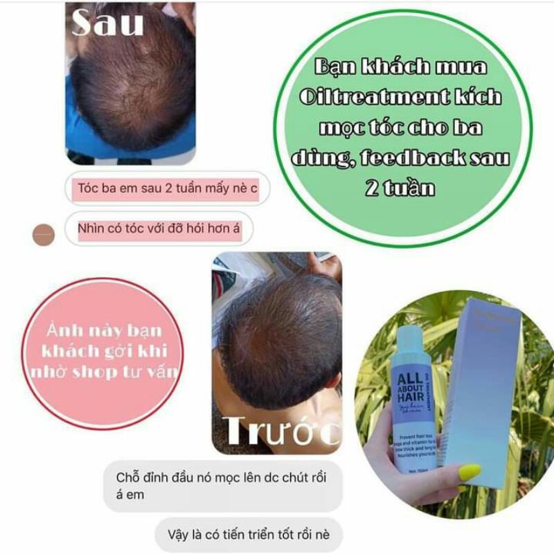 Ủ Kích Mọc Tóc oil treatment tặng kèm hủ hair repair | 🎁 Tặng mũ trùm ủ tóc | BigBuy360 - bigbuy360.vn