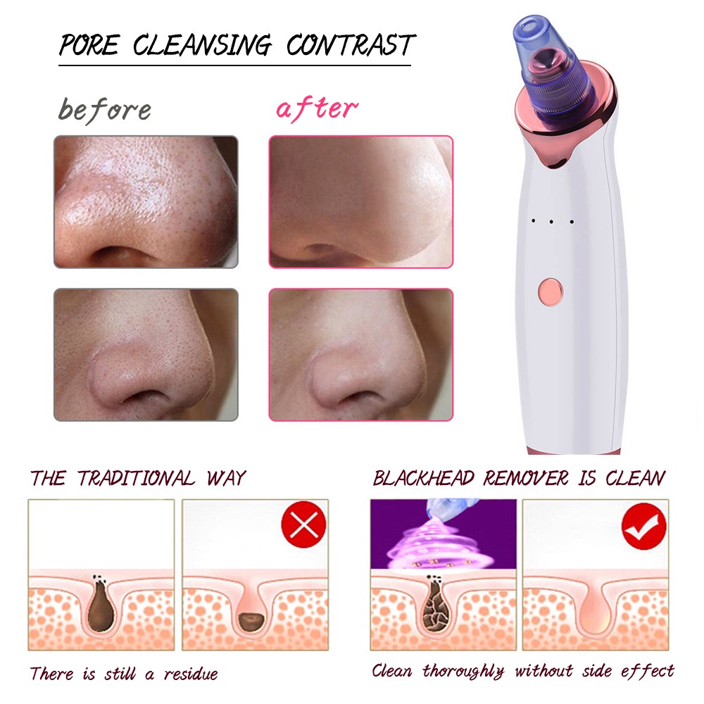 Máy Hút Mụn Đầu Đen Làm Sạch Lỗ Chân Lông Tinh Chất Trà Xanh