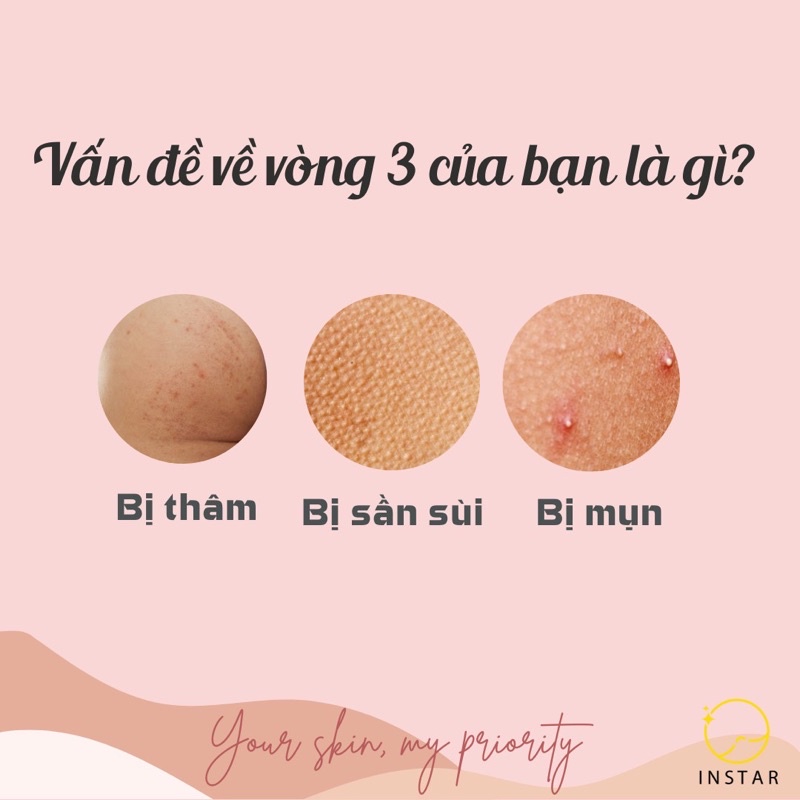 XÀ BÔNG GIẢM MỤN THÂM MÔNG NHẬT BẢN 100% HIỆU QUẢ MIWAKU NO OSHIRI - DƯỠNG TRẮNG DA VÒNG 3