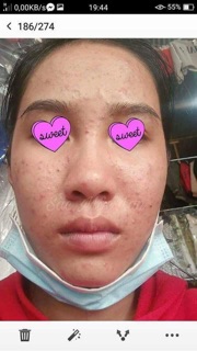 Thảo dược Đông y Sắc Mộc Lan