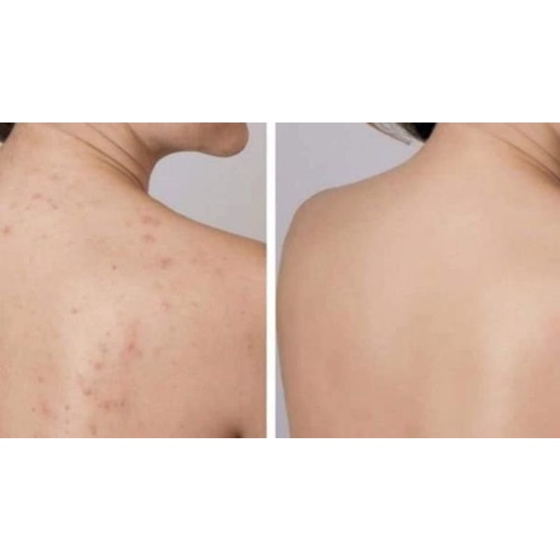 TÔI ĐANG BÁN XÀ PHÒNG LƯU HUỲNH CHỈ CÓ 129 K