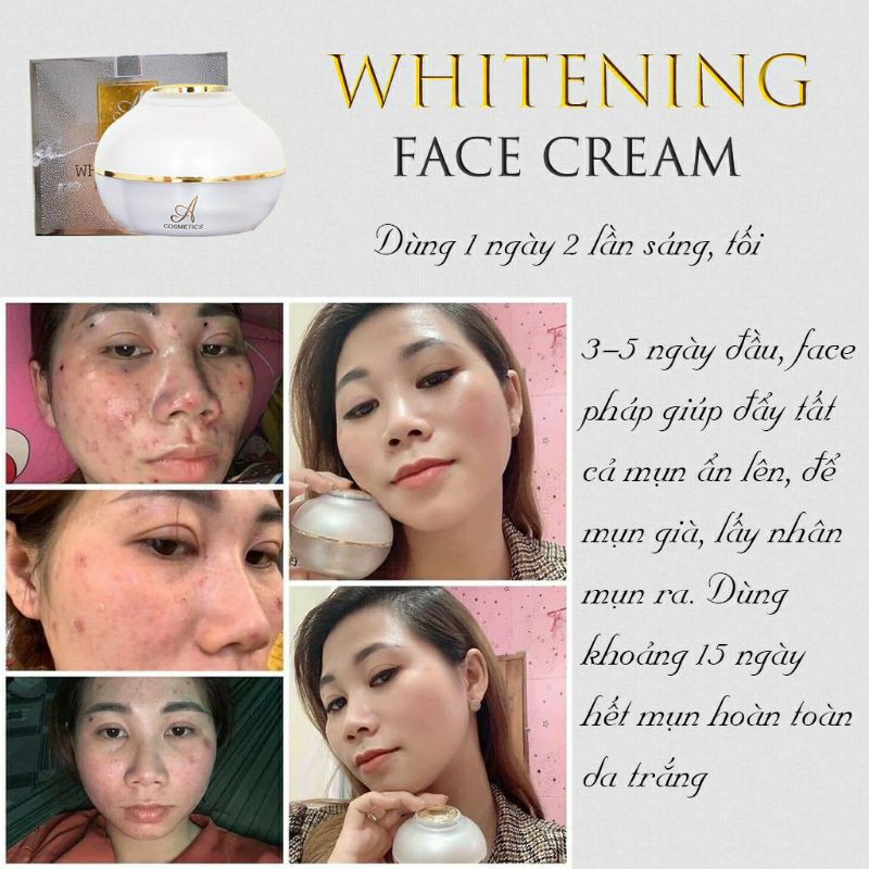 Kem face phuong anh kam kết chinh hang so luong 9x ib | BigBuy360 - bigbuy360.vn