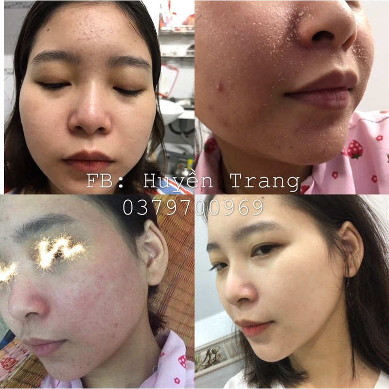 THUỐC BẮC TÁI TẠO DA (HANDMADE) 125ml | BigBuy360 - bigbuy360.vn