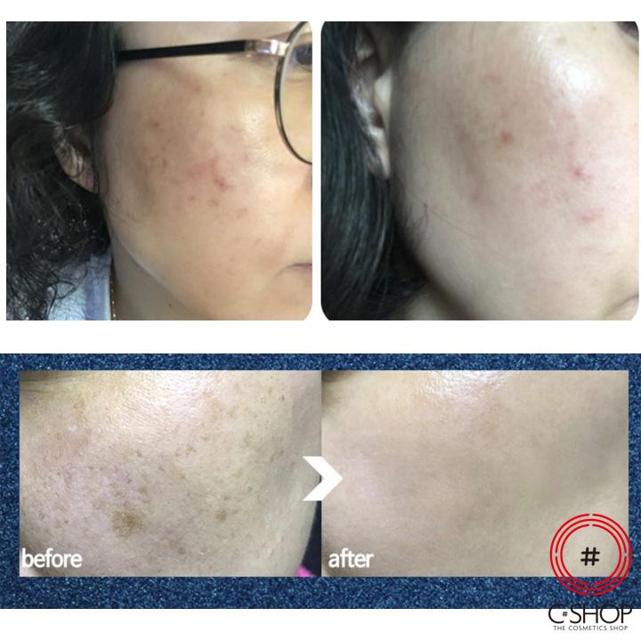 Serum chăm sóc da 4 trong 1 MODEEP No Meela Serum_Mỹ phẩm Hàn Quốc chính hãng