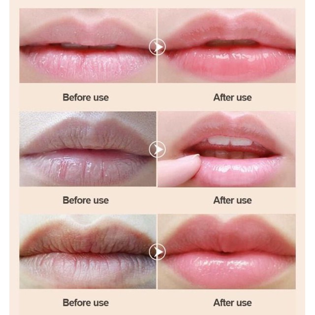 ( Mypham35 ) Mặt nạ chăm sóc môi mask hip | BigBuy360 - bigbuy360.vn