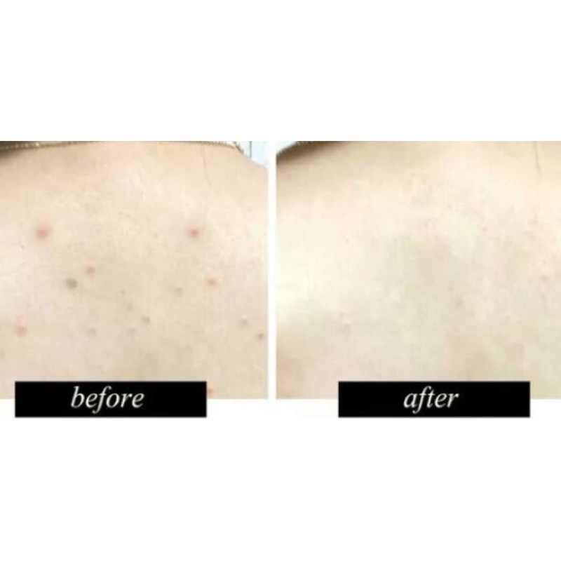 XỊT KHOÁNG KIỂM SOÁT NHỜN VÀ MỤN DR.YOUNG CONTROL U LINE CLEARING MIST (Hàn quốc) | BigBuy360 - bigbuy360.vn