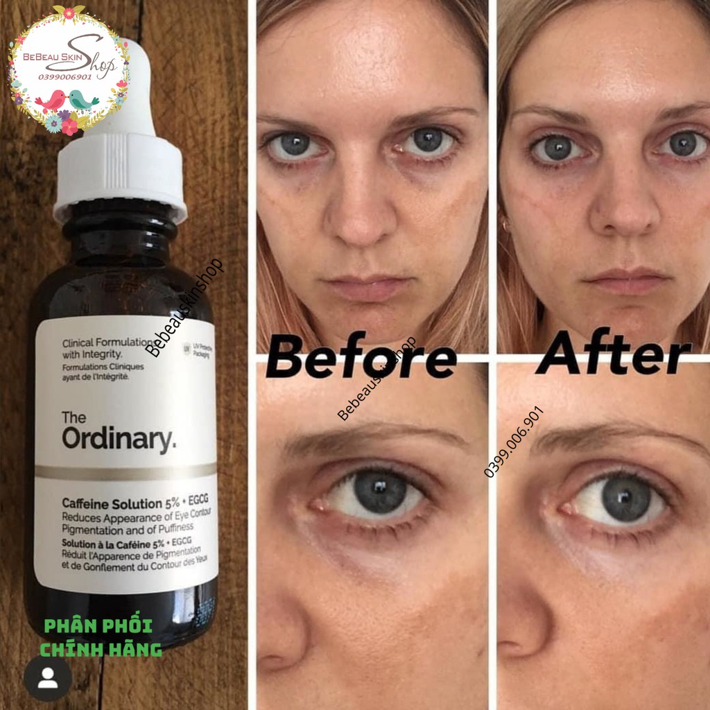 The Ordinary Caffein Solution 5% + EGCG -  Tinh chất dưỡng mắt giảm thâm, bọng mắt [ Chính Hãng ]