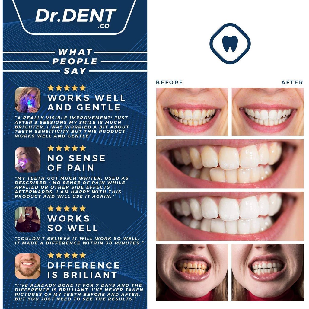 Set trắng răng cao cấp Dr Dent Premium Teeth Whitening