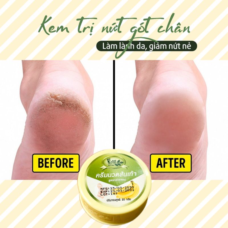 ( 🇹🇭 🇹🇭Hàng Thái Lan chính hãng) Kem nứt gót chân Banana Heel cream