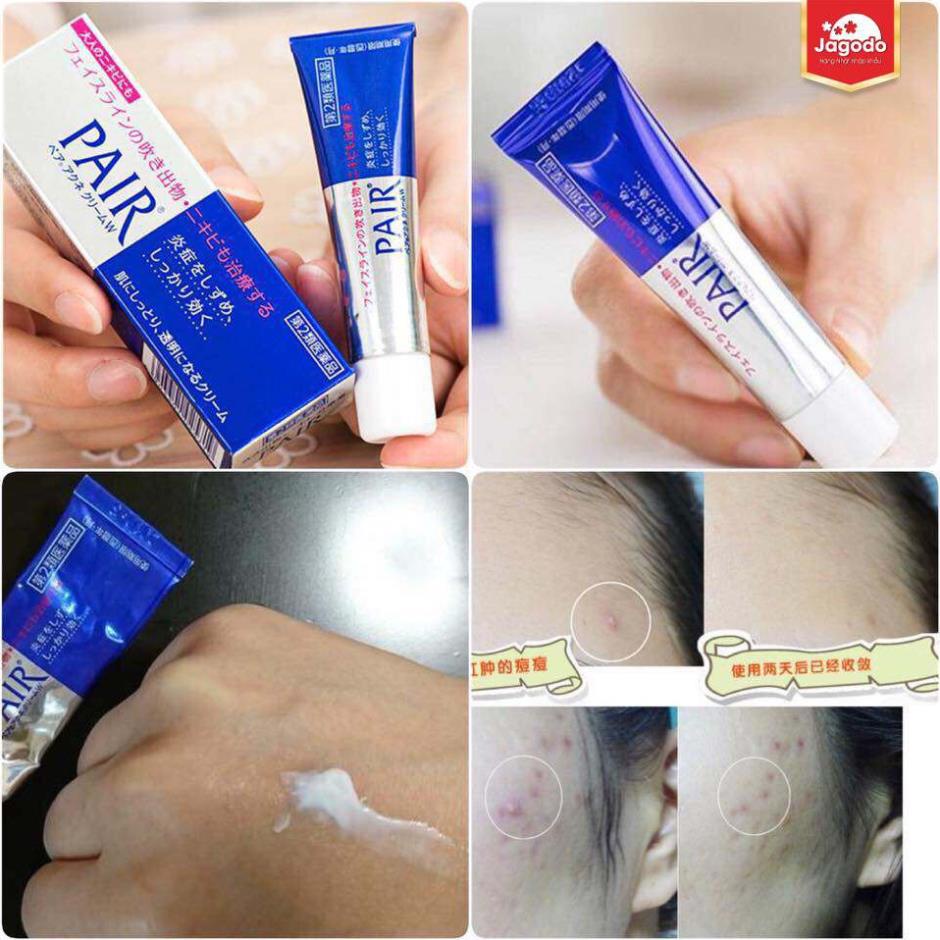 Kem ngừa mụn Pair Acne W Cream Nhật Bản - Kem mụn PAIR Nhật Bản 24gr sạch mụn chỉ trong 7 ngày