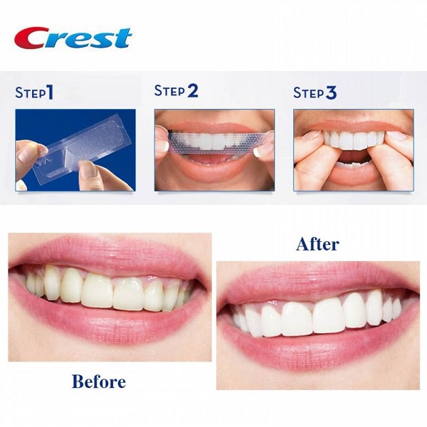 [1 GÓI LẺ] Miếng dán trắng răng Crest 3D White - Mỹ (Professional Effects/ Supreme Flexfit/ Glamorous white/ 1 hour)