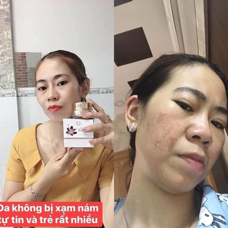 kem nám safaron (hải âu việt) lọ 10 gam