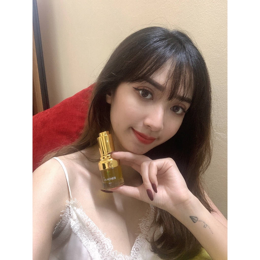 Serum giảm mụn mỹ phẩm cho bà bầu V9Queen tinh chất rau má mờ thâm dưỡng trắng da