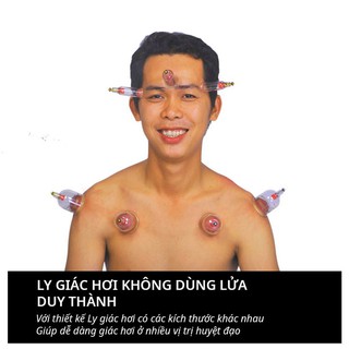 Combo Bộ 20 ly giác hơi S1 (loại thường)