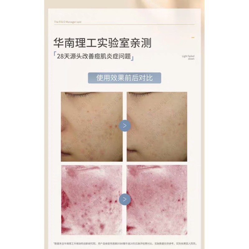 [SẴN] Serum B56 phục hồi da Lucenbase | BigBuy360 - bigbuy360.vn