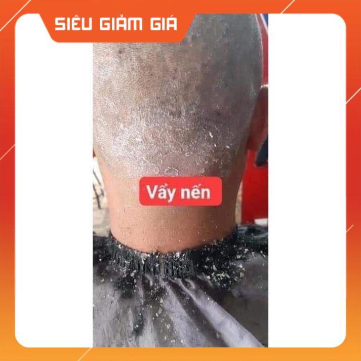 Kem bôi da kem bôi tổ đỉa ghẻ nước nấm ngứa các loại, thảo dược tự nhiên