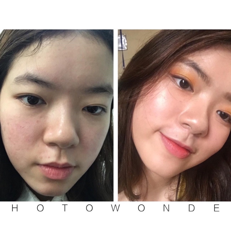Combo đặc trị mụn gồm 3 sản phẩm