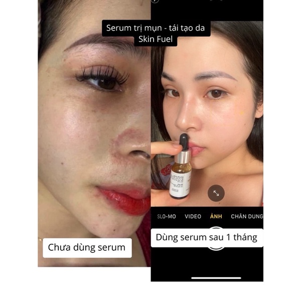 Serum tái tạo làn da Skin Fuel | BigBuy360 - bigbuy360.vn