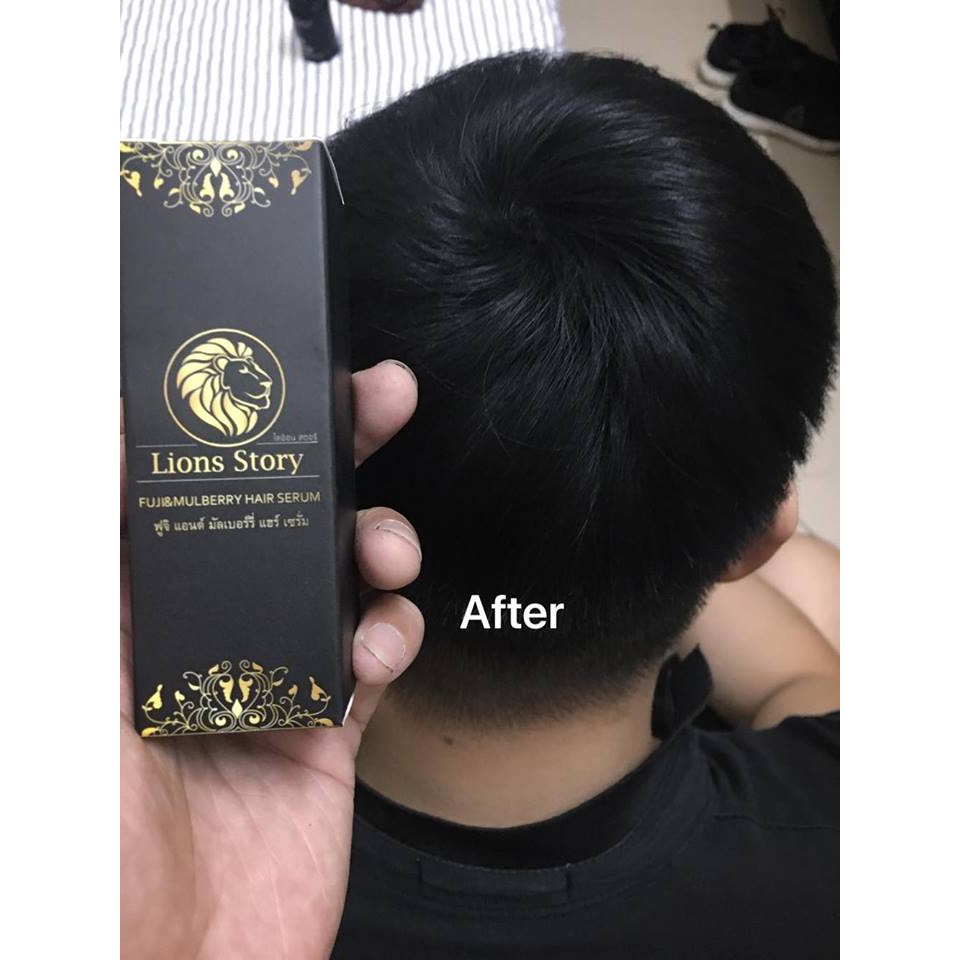 [GIẢM SỐC] Tinh dầu mọc tóc Lions Story Thái Lan