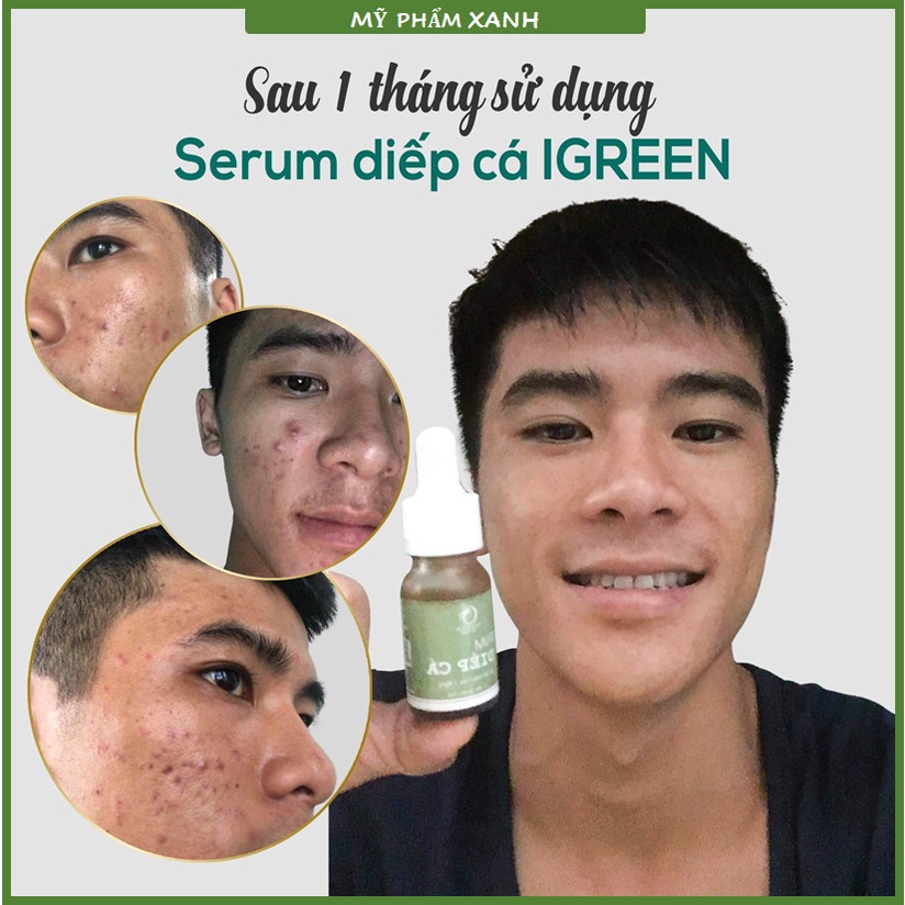 Serum diếp cá Igreen 10ml sạch mụn thâm se khít lỗ chân lông, nuôi dưỡng da căng bóng mịn màng