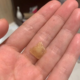 Miếng dán mụn DUODERM