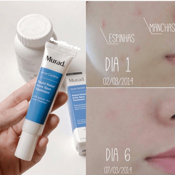 Gel Trong Suốt Giảm Mụn 4H - Murad Rapid Relief Acne Spot Treatment