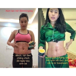 TAN MỠ SLIMMING COLLAGEN