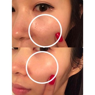 [TUÝT 20M] THAY DA SINH HỌC RED PEEL