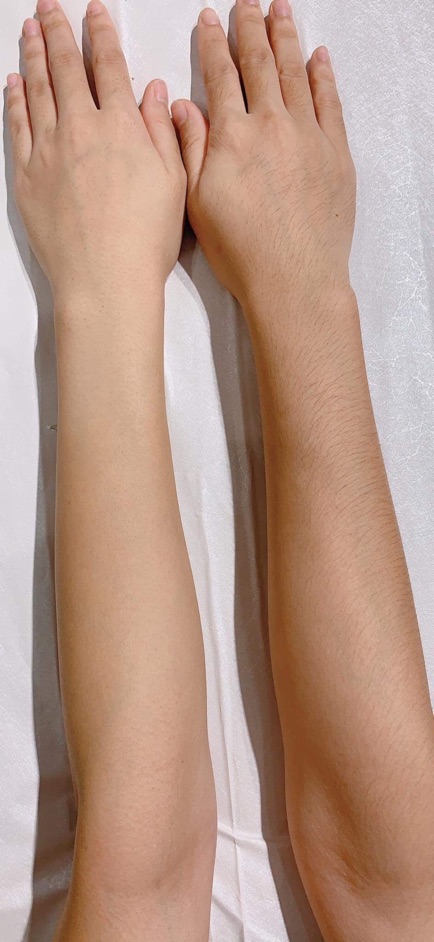 Combo Kem Tẩy Lông Và Serum Ức Chế Be.Cosmetic Triệt Sạch Lông Nhanh Chóng