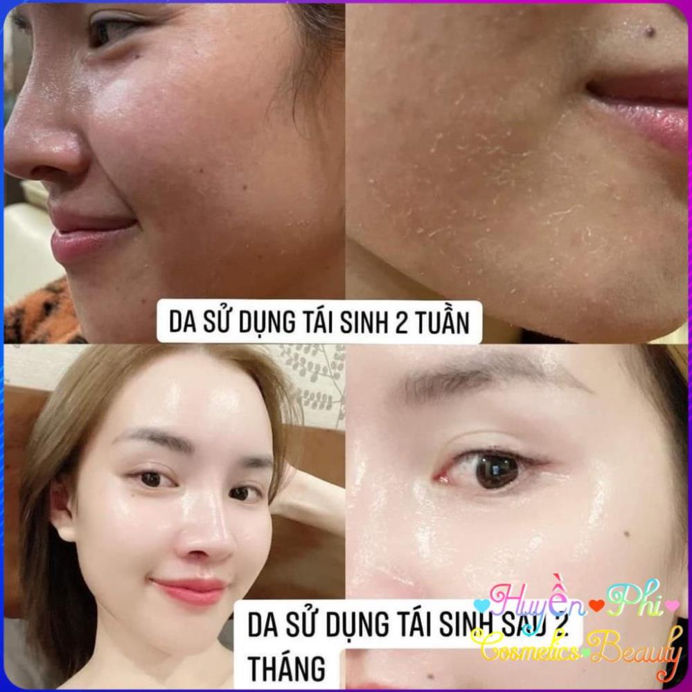 Combo Bộ Tái Sinh Retinol Complex Huyền Phi, Kem Phục Hồi Heli B5 Cream Dưỡng Da Tái Tạo Chăm Sóc Làn Da Khỏe Mạnh