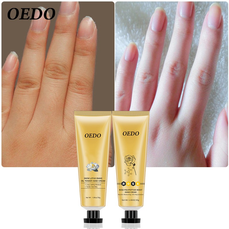 Kem dưỡng da tay Peptides OEDO làm sáng dưỡng ẩm và trắng da | BigBuy360 - bigbuy360.vn