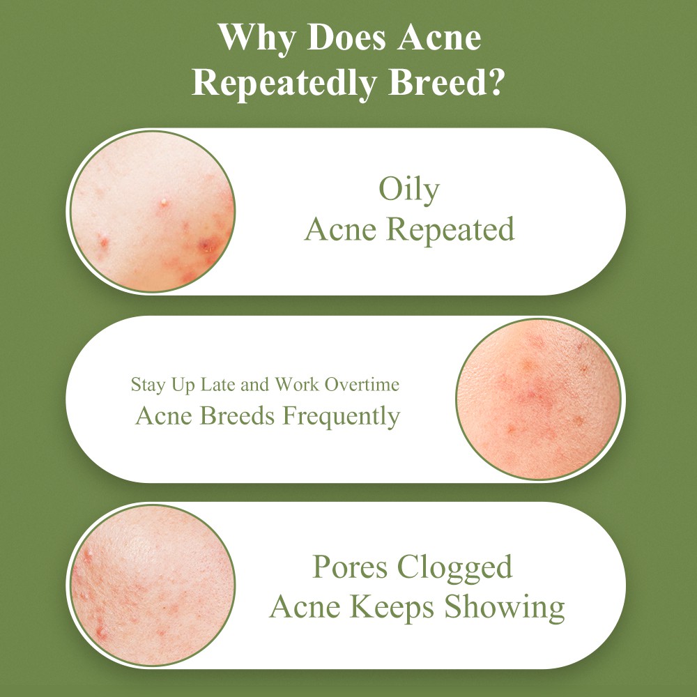 BREYLEE 15g Hỗ Trợ Chăm Sóc Gel Da Và Loại Bỏ Mụn