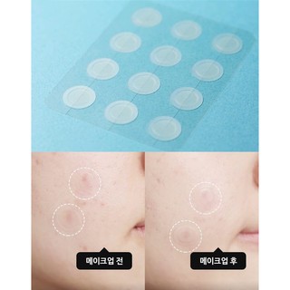 Miếng dán mụn Olive Young CarePlus