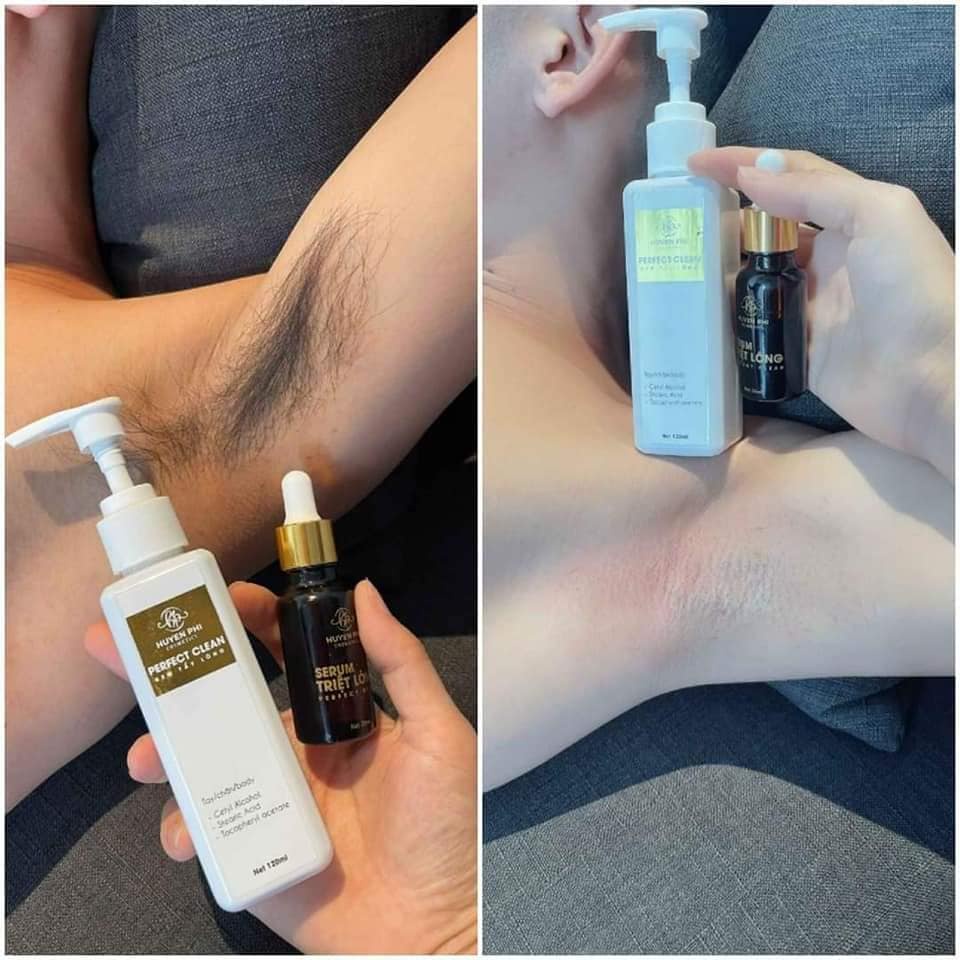 Kem Tẩy Lông Huyền Phi - Tặng Serum Triệt Lông . Tẩy lông nách , lông chân. An Toàn Không Đau Rát. Hiệu quả và an toàn