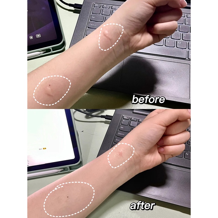 Kem Chống Muỗi Hengai 6.5g Nhỏ Gọn Tiện Dụng