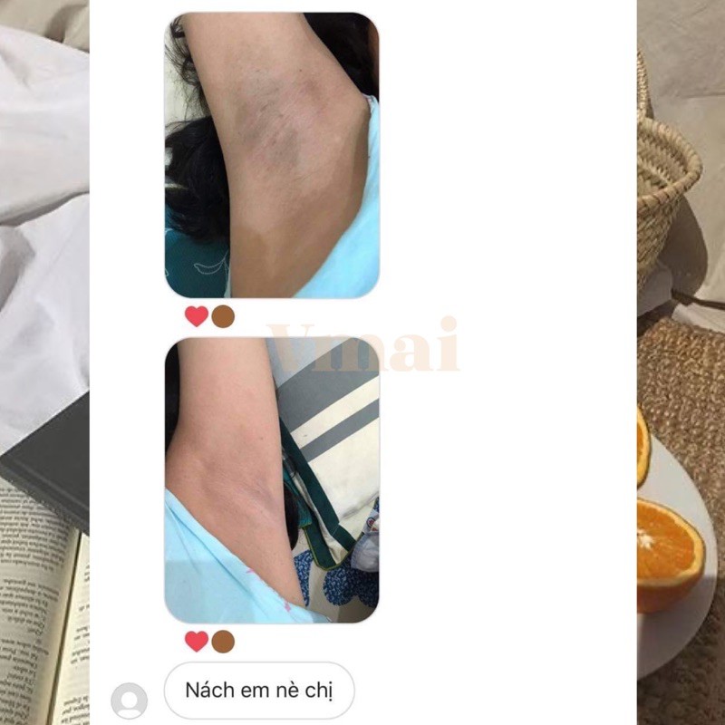 Gel dưỡng trắng - ngừa thâm hãng gluta-c (kèm feedback) | BigBuy360 - bigbuy360.vn