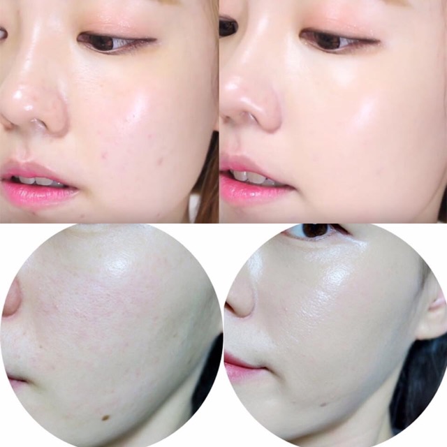 PHẤN NƯỚC CUSHION LIME REAL COVER PINK SPF 50/PA+++