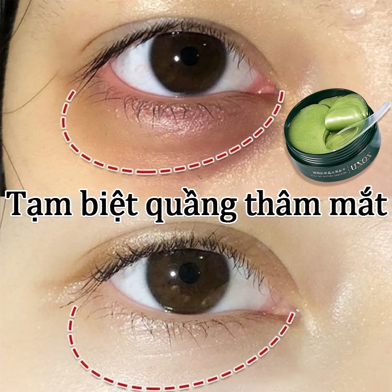 Mặt nạ mắt gel Gel trắng da mặt Giảm quầng thâm 80g vùng quanh mắt sưng tấy Làm sáng vùng thâm dưới da Giảm nếp nhăn