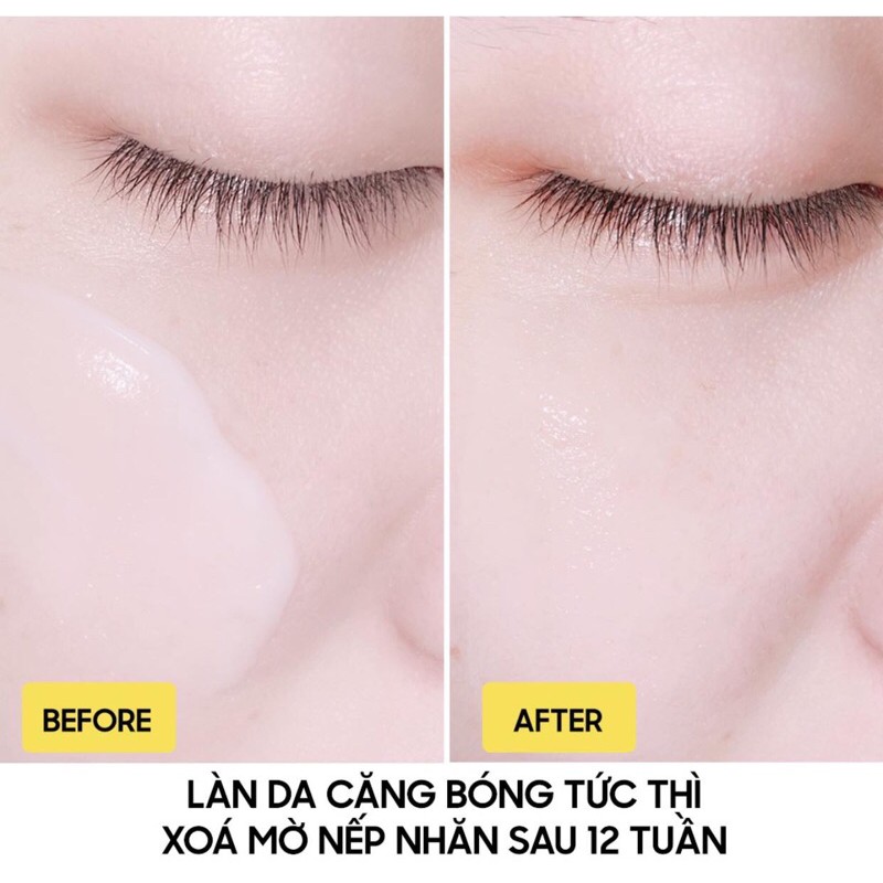 KEM DƯỠNG EPONA RED GOLD WHITENING