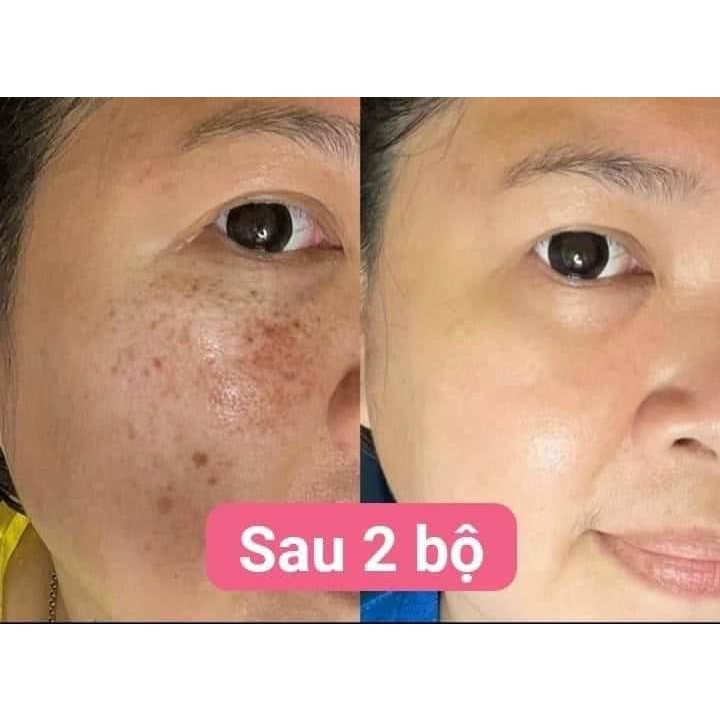 Bộ Mỹ Phẩm Shengposay Cao Cấp Hàn Quốc 7in1 Chính Hãng Phục Hồi Tái Tạo Làn Da Mờ Nám Tàn Nhan