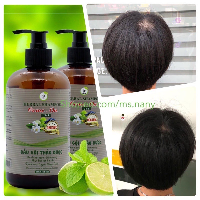 Dầu gội thảo dược mọc tóc, ngăn rụng tóc 500ml - Come On 2in1 | BigBuy360 - bigbuy360.vn
