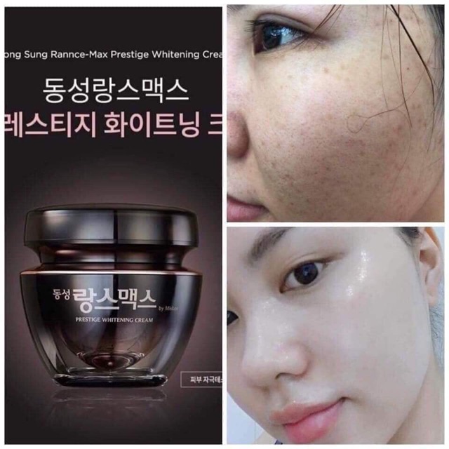 Combo Kem và Serum Dưỡng Da Mờ Nám Trắng Da Dongsung mẫu mới